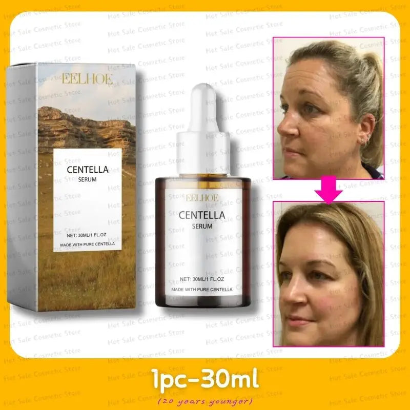 Koreanisches Centella Asiatica Gesichtsserum Pflegt trockene Haut Glättung Verjüngung Hautaufhellung Whitening Creme Gesichtsfeuchtigkeitspflege